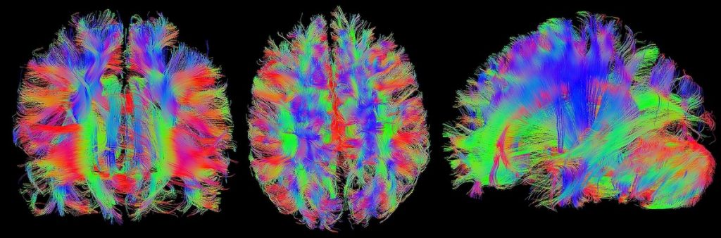 psicoterapia e neuroimmagine