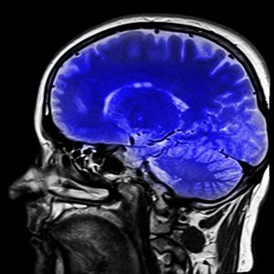 psicoterapia e cervello