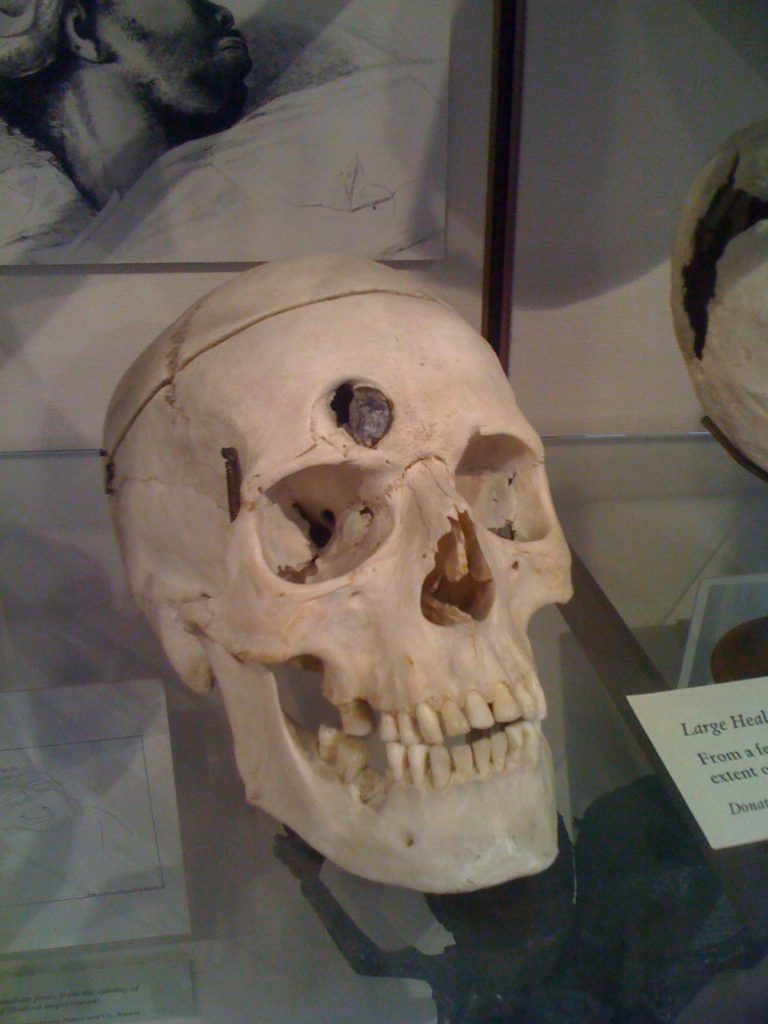cranio gage