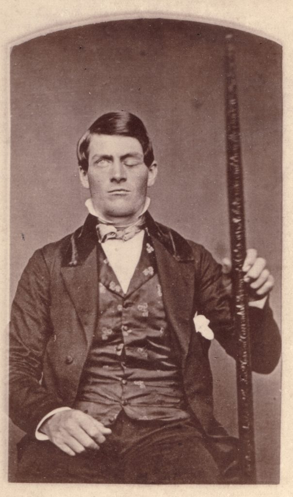 Phineas Gage